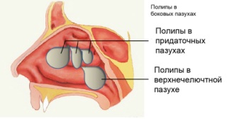 Виды и классификация заболевания.