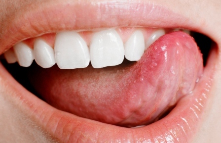 Симптомы и причины проявления зубного камня