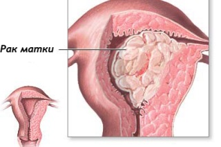 Классификация и симптомы проявления.