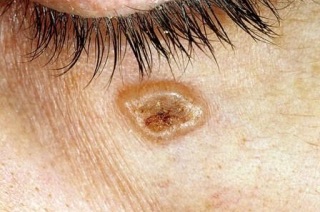 Причины проявления заболевания.