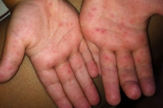 Причины проявления возникновения.