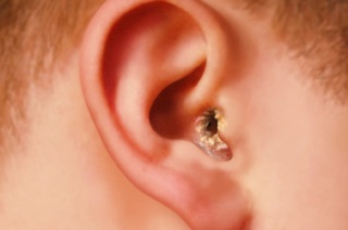 Симптомы проявления заболевания.