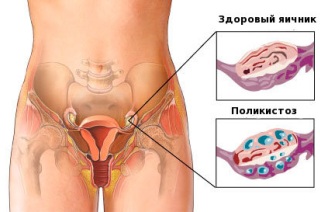 Причины проявления заболевания.