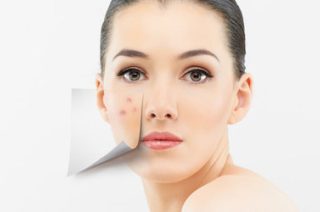 Причины и симптомы проявления розацеа на лице