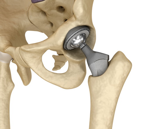 Суть процедуры