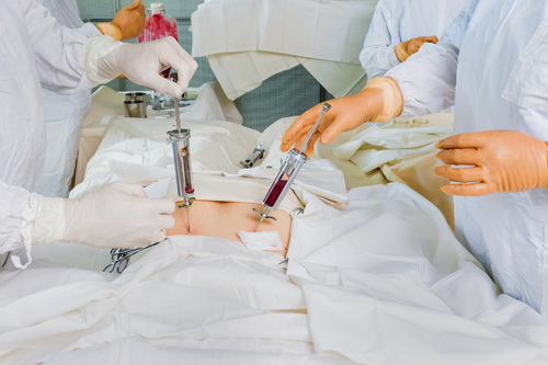 Пересадка костного мозга в Израиле