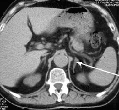 Аденома: фото и характеристика