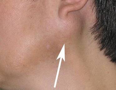 Аденома: фото и характеристика