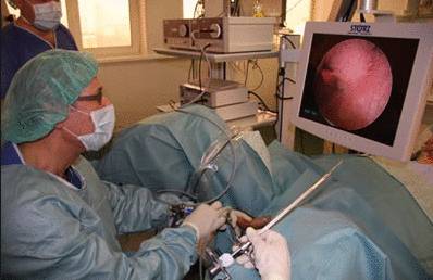 Биопсия мочи