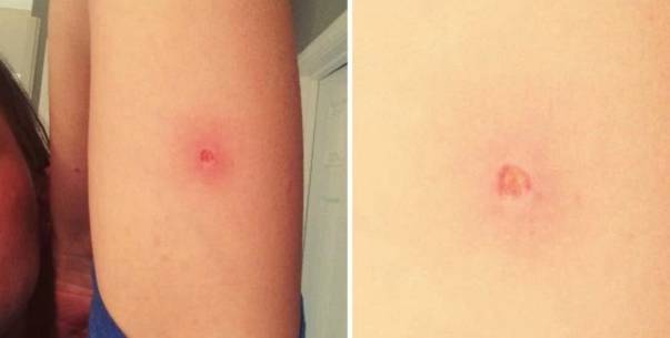 chto-budet-esli-otorvat-rodinku