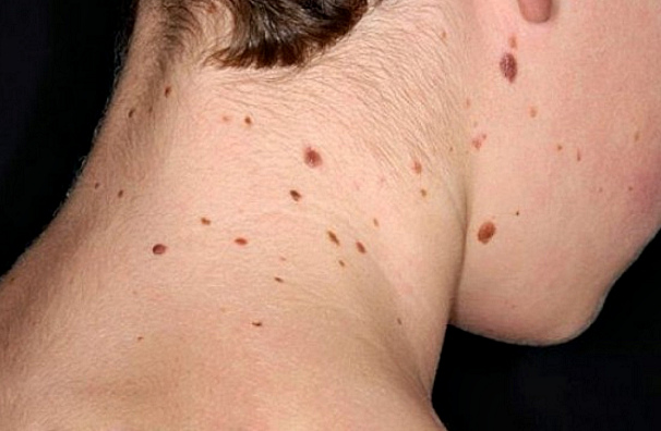 dobrokachestvennye rodinki