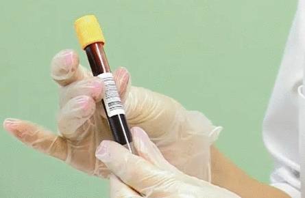 faktor nekroza opuxoli