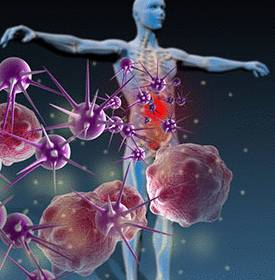 Фактор некроза опухоли