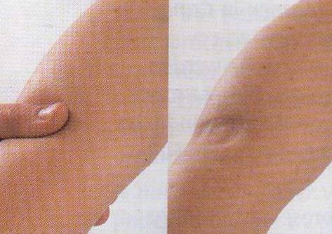 Лимфа в ногах: что делать?