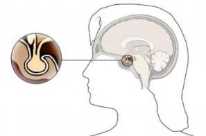 Новообразования у женщин. Фото, описание