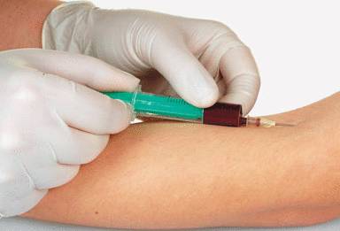 онкомаркеры поджелудочной