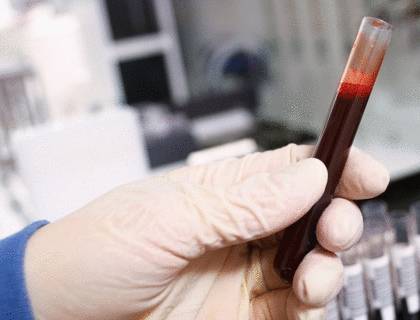 онкомаркеры желудка