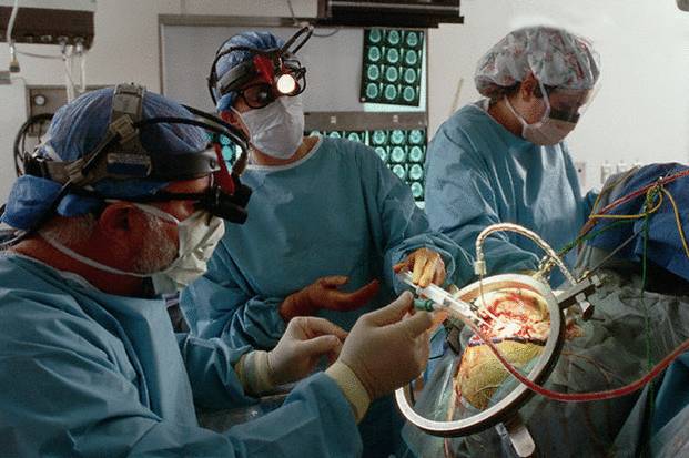 Операция по удалению менингиомы: прогноз, осложнения