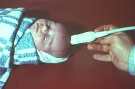 Опухоль мозга у ребенка: как распознать быстро?