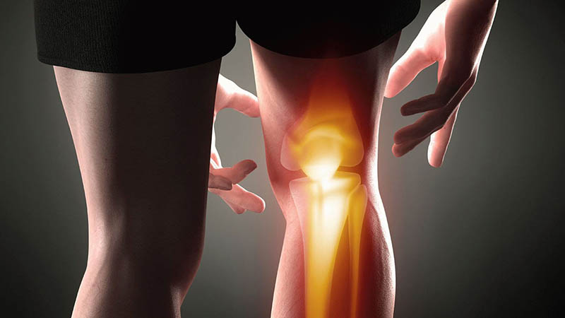 Как лечат артроз коленного сустава