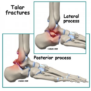 Анатомия голеностопного сустава