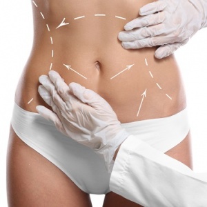 Что такое радиочастотная липосакция и в чем её преимущества