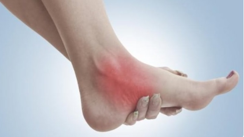 Как лечить бурсит голеностопного сустава