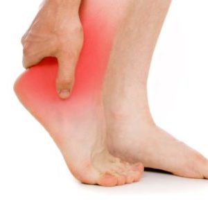 Как лечить деформацию Хаглунда (апофизит)