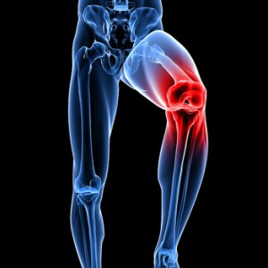 Как лечить истончение гиалинового хряща коленного сустава