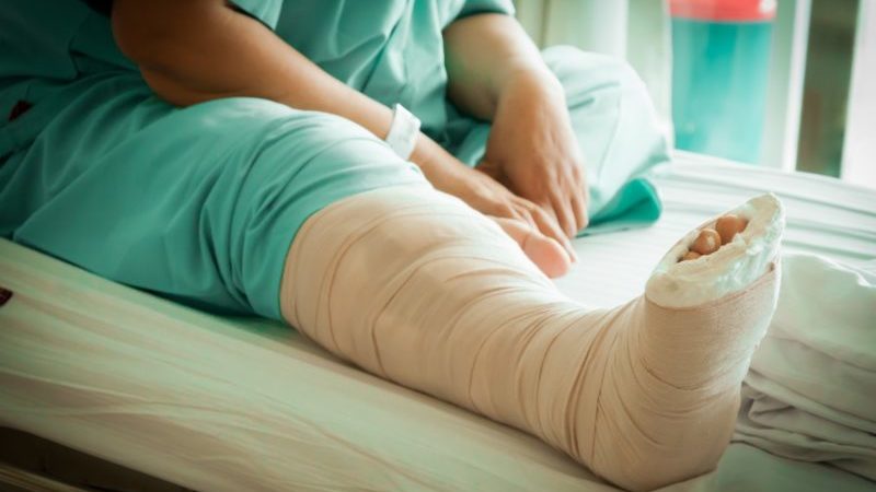 Как лечить крузартроз голеностопного сустава