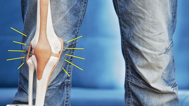 Как лечить трещину коленной чашечки