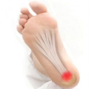 Ортезы при лечении пяточной шпоры