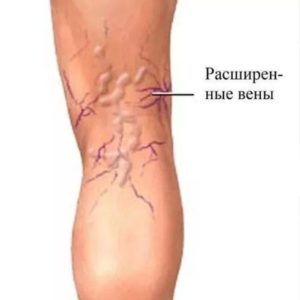 от чего могут отекать ноги
