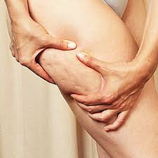 Почему целлюлита стало больше после массажа