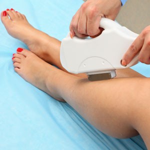 Что такое AFT эпиляция