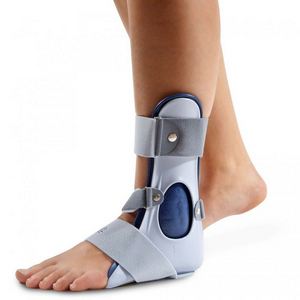 Как лечить артроз голеностопного сустава