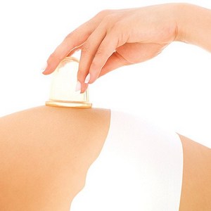 Как правильно делать баночный массаж от целлюлита