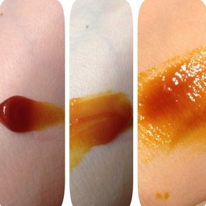 Лечение грибка ногтей препаратом Бетадин