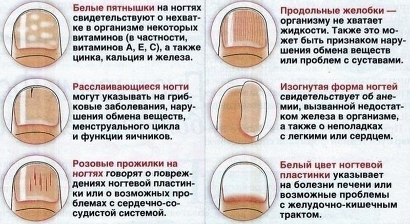 Какие существуют заболевания ногтей на ногах