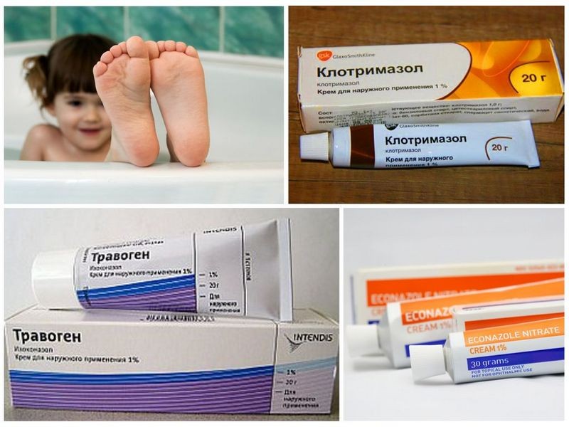 Лечение грибка ногтей на ногах у детей