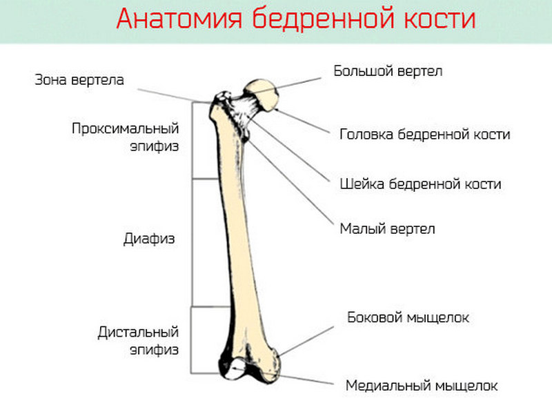 Как лечат чрезвертельный перелом бедра