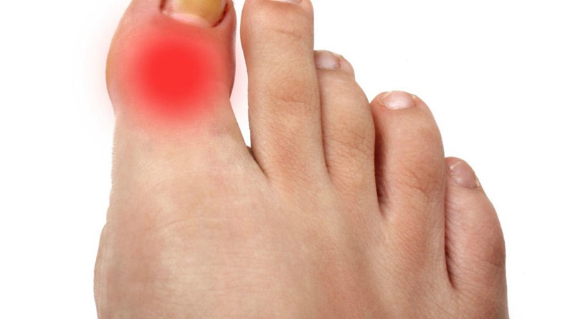 Что делать, если болит сустав большого пальца на ноге