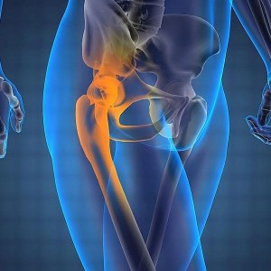 Что делать при болях в бедре