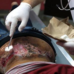 Эбермин (Hebermin): инструкция по применению мази