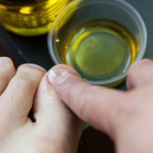 Какие масла можно использовать для лечения грибка ногтей