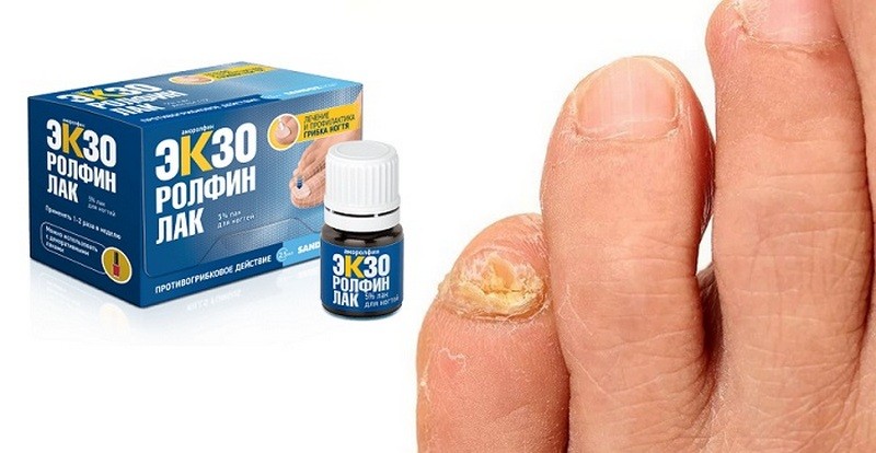Инструкция по применению Экзоролфинлака для лечения грибка