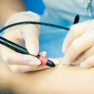 Как правильно делается электроэпиляция глубокого бикини