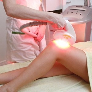 Элос (Elos) эпиляция – избавляемся от волос навсегда