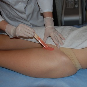 Восковая эпиляция зоны бикини в домашних условиях