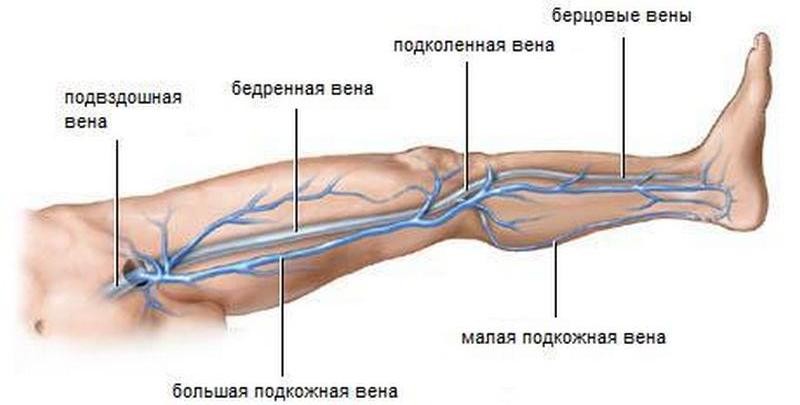 Что такое флеботромбоз, чем он отличается тромбофлебита и как его лечить